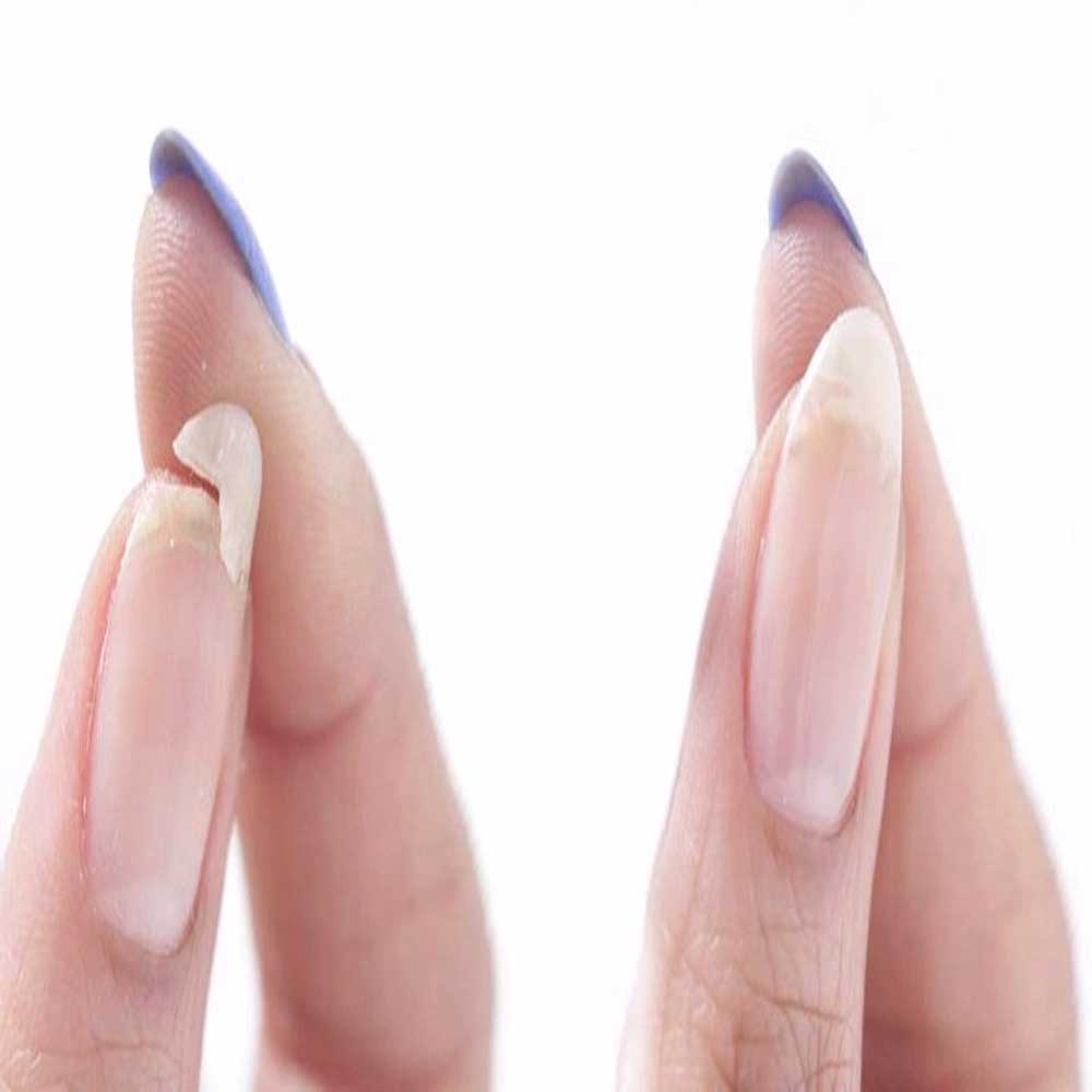 راهکارهای مناسب جهت داشتن ناخن های مقاوم چیست